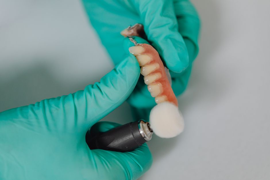 implantes dentales precio